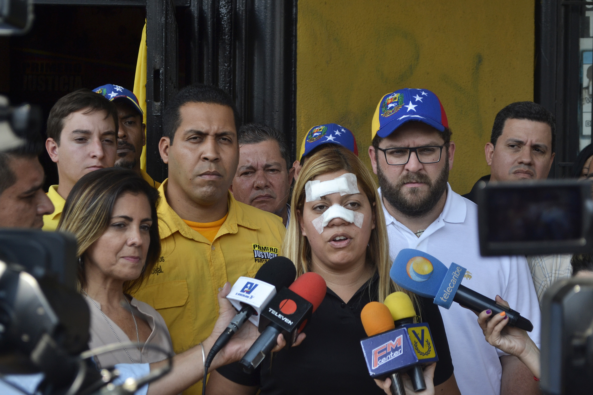 Así le dejaron el rostro a Beatriz Pérez: PJ solicita destituir a concejal del PSUV por agresión (Fotos)