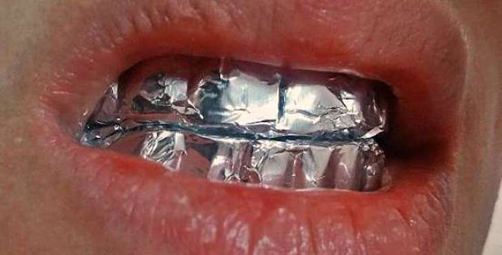 Cereal Notorio efectivo Cómo blanquear los dientes con papel de aluminio? - LaPatilla.com