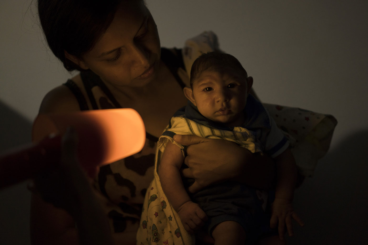 Nace bebé con microcefalia en Dominicana