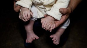 El sorprendente caso del niño que nació con 31 dedos (FOTOS)
