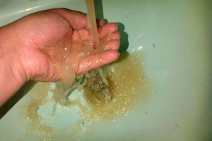 Habitantes de Tucupita denuncian que casos de sarna aumentan por agua contaminada