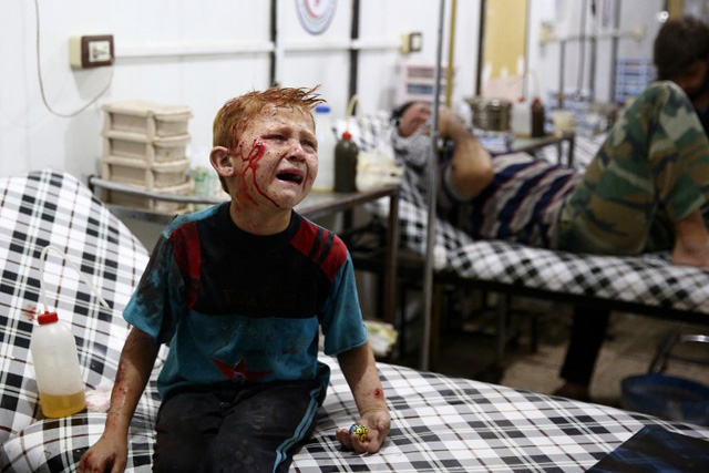 Salam, an injured eight-year-old Syrian boy, cries as he waits for medical care at a makeshift clinic after a reported air strike on July 16, 2016 in al-Rehan, near Douma, a rebel-held town east of the capital Damascus. / AFP PHOTO / Abd Doumany
