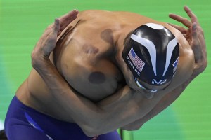 Los extraños moretones en la piel de Michael Phelps (fotos)