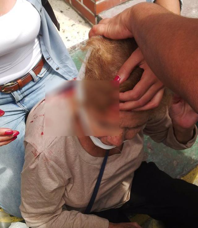 Señora de 79 años de edad herida durante represión en protestas de Mérida 26-10-2016. Foto: @alfredoromero 