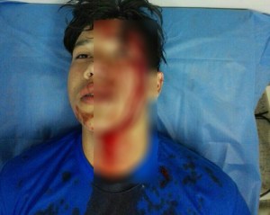 FCU-UCV: Más de 50 estudiantes heridos por represión militar y policial