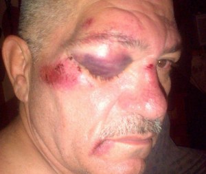 Presuntos oficialistas golpearon brutalmente a dirigente de Catia y funcionario de la AN