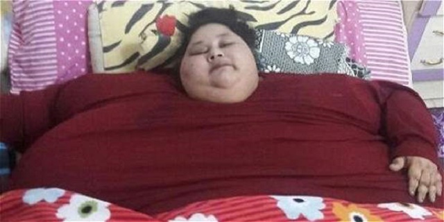 La mujer más obesa del mundo se recupera tras una cirugía para reducir su peso