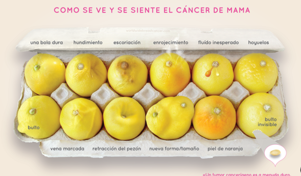 12 limones que pueden ayudarte a detectar el cáncer de mama