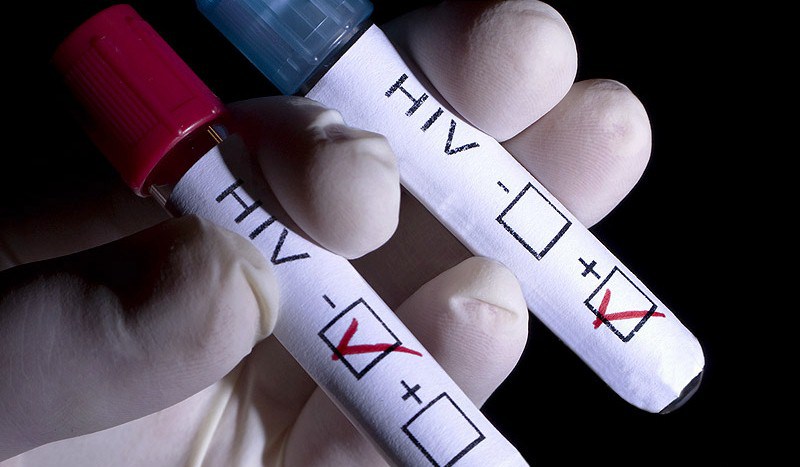 Abren el primer banco de esperma del mundo de portadores del VIH