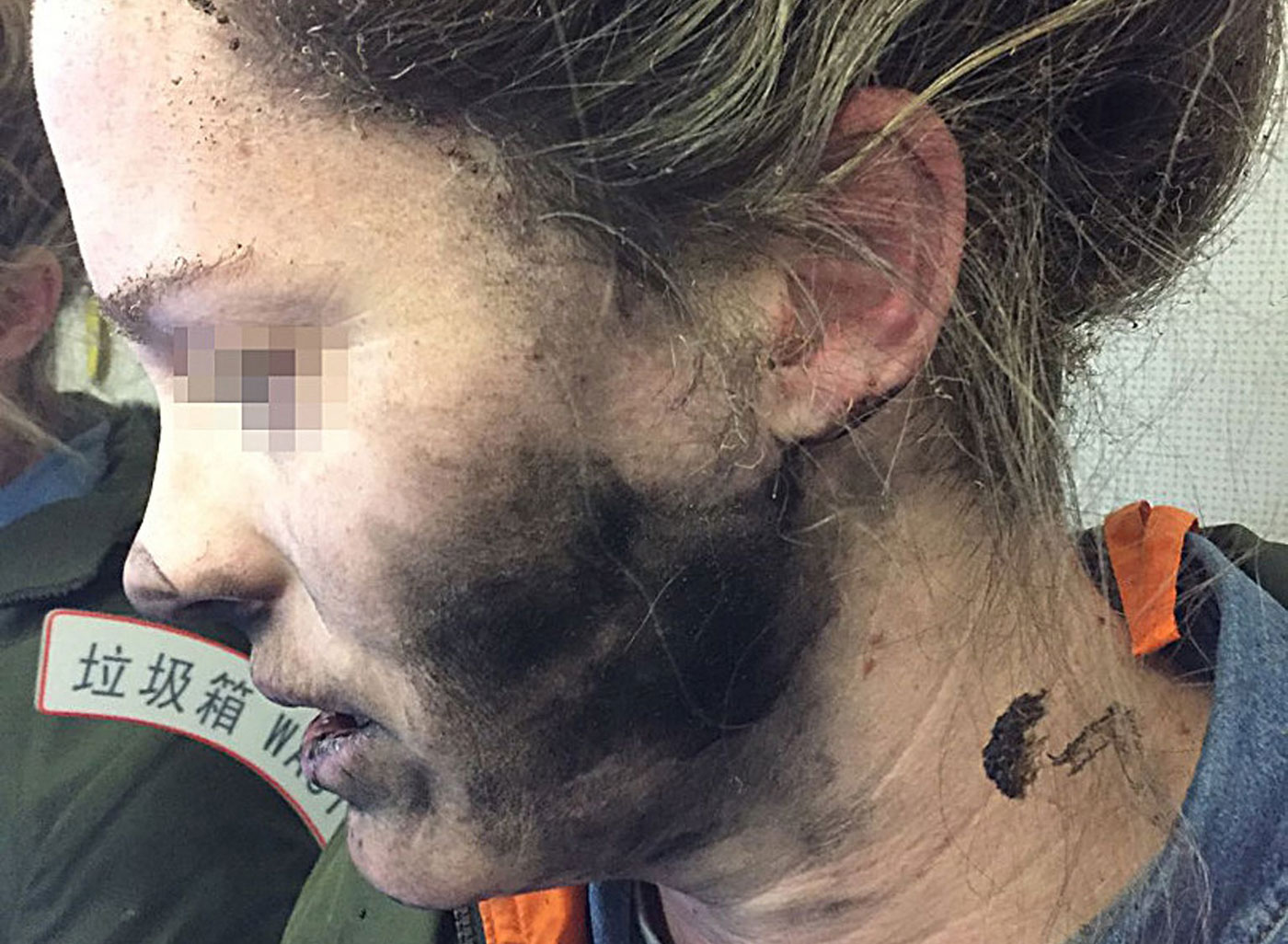 Una mujer sufre quemaduras al explotarle auriculares en un vuelo hacia Australia (fotos)