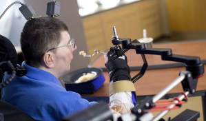 Un tetrapléjico volvió a comer solo gracias a una prótesis conectada a su cerebro