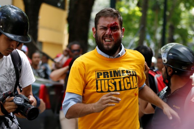ATTENTION EDITORS - VISUAL COVERAGE OF SCENES OF INJURY OR DEATH   Juan Requesens (C), deputy of the Venezuelan coalition of opposition parties (MUD), reacts after been injured during clashes with pro-government supporters outside the offices of the Venezuela's ombudsman in Caracas, Venezuela April 3, 2017. REUTERS/Carlos Garcia Rawlins   TEMPLATE OUT     TPX IMAGES OF THE DAY