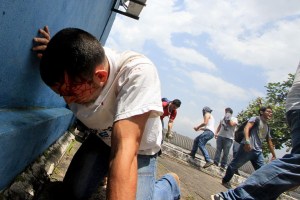 Represión de la GNB deja al menos 20 estudiantes heridos Táchira (fotos+videos)