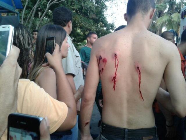 Uno de los heridos en la Universidad de Carabobo. Foto: Andrews Abreu