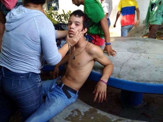 Uno de los heridos en la Universidad de Carabobo. Foto: Gabriela Suniaga