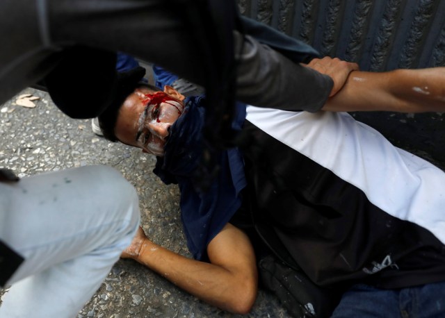 A demonstrator receives help after sustaining injuries during clashes with the riot police at a rally in Caracas, Venezuela, April 8, 2017. REUTERS/Carlos Garcia Rawlins