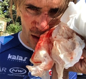 Agreden violentamente a ciclista francés mientras se entrenaba