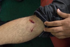 Herido por lacrimógena fotógrafo de La Patilla #26Abr (fotos)