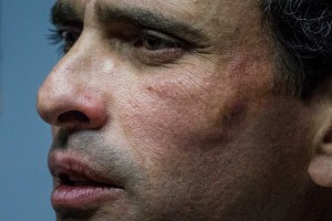 En VIDEO: El momento preciso cuando la GNB golpea y roba a Capriles y su equipo