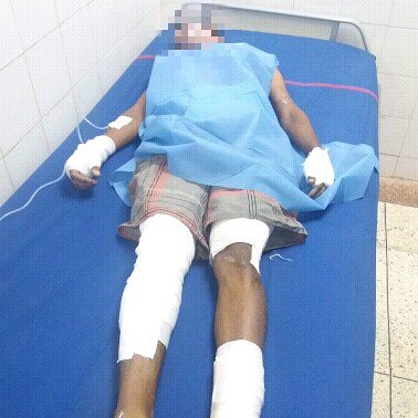 @PableOstos / Joven atendido en Guayana tras ser arrollado por un vehículo 
