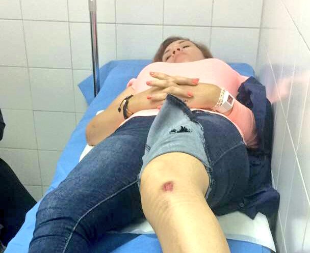 Heridos activistas de Voluntad Popular durante represión en Maracaibo