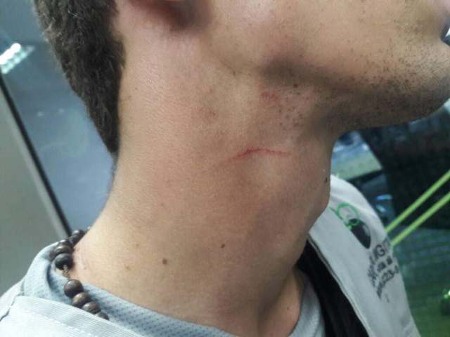 Pérez recibió una cortada leve en el cuello por parte de los agresores (Foto: @SNTP)