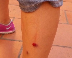 Diputada Carmen Maria Sívoli resulta herida durante represión en Mérida #22Jun