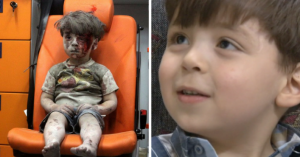 El antes y después del niño sirio que se convirtió en símbolo del horror de la guerra en Siria (foto)