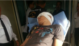 Joven herido de perdigón en la cabeza tras represión en El Tulipán