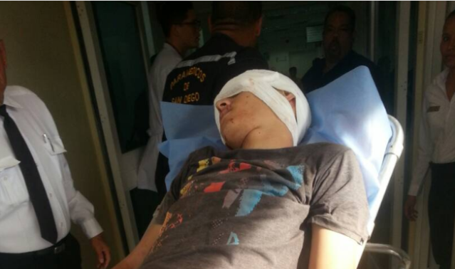 Luis Espino a de 16 años heridos por perdigón en Los Tulipanes. Foto: @DouglasJimenez