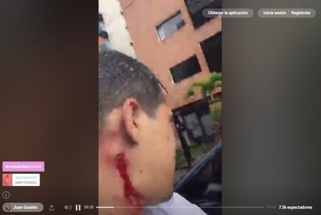 Herida que recibió el diputado Juan Guaidó durante el trancazo de este miércoles 28 de junio. Foto: Captura de video.