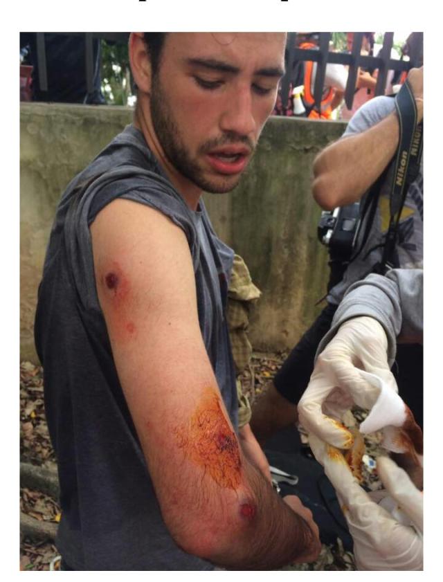 A Gustavo Vera de El Estímulo le dispararon a quema ropa pese a haberse identificado como trabajador de la prensa. Foto: Cortesía