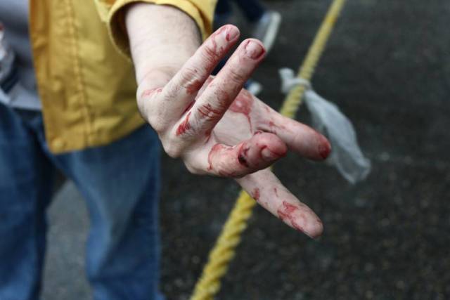 Un manifestante fue herido con perdigón en Macaracuay (Foto: Will Jiménez / LaPatilla)