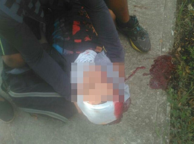 El joven resultó herido durante el plantón en Tulipán, Carabobo. Foto: @Heberlizeth 