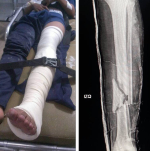 José Manuel Olivares: Niño de 14 años fue arrollado por una tanqueta en Mérida (Fotos)