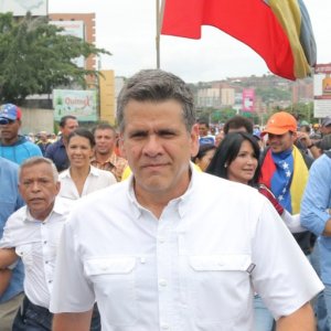 Diputado Rafael Guzmán recibió un perdigonazo durante represión en Montalbán este #3Jun