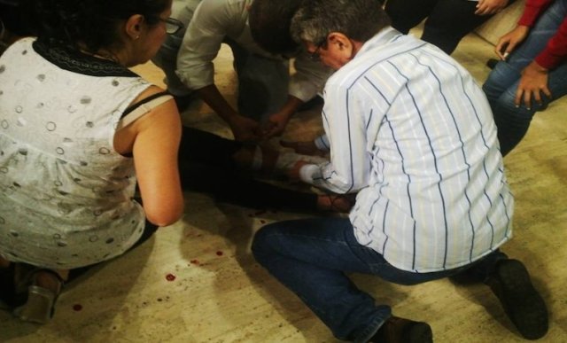Foto: Mujer herida por fuegos artificiales durante trancazo en la Av. Urdaneta / Cortesía 