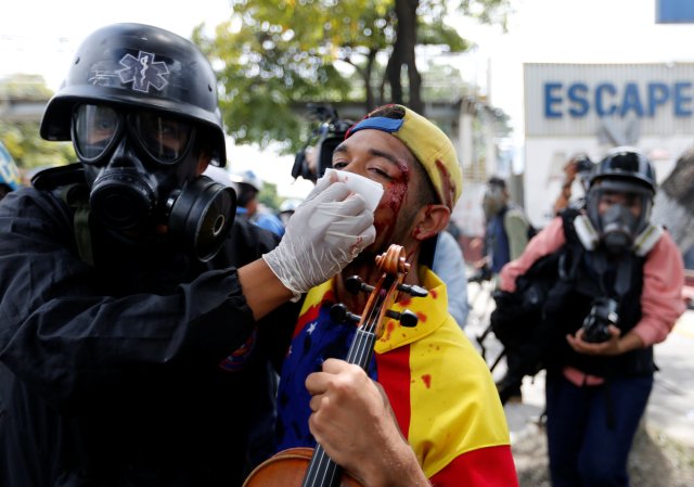 El violinista Wuilly Arteaga resultó herido durante la represión en Bello Campo.  REUTERS/Andres Martinez Casares TEMPLATE OUT