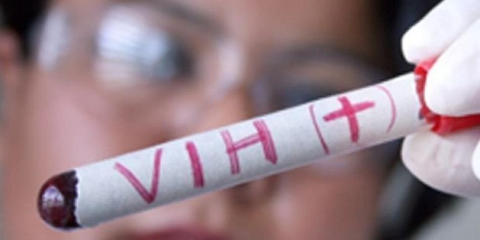 El VIH avanza rápidamente en una comunidad indígena venezolana (estudio)