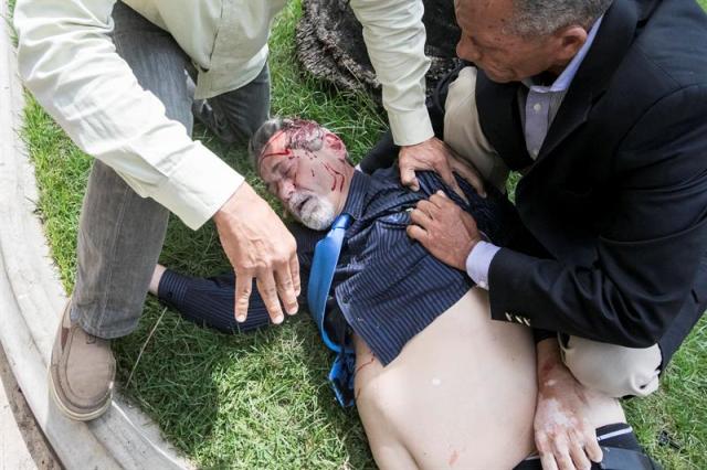  El diputado por el estado Bolívar, Américo de Grazia fue brutalmente maltratado. EFE