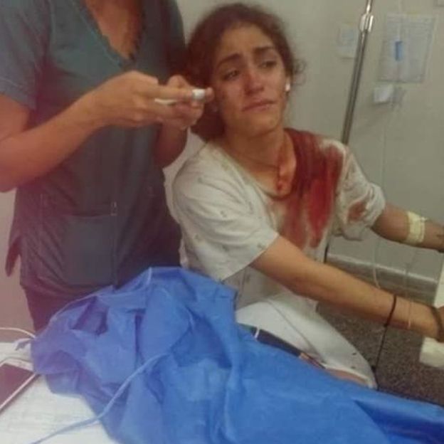 Carmen Ángel necesitó suturas en la cabeza y tuvo fracturas en los dedos.