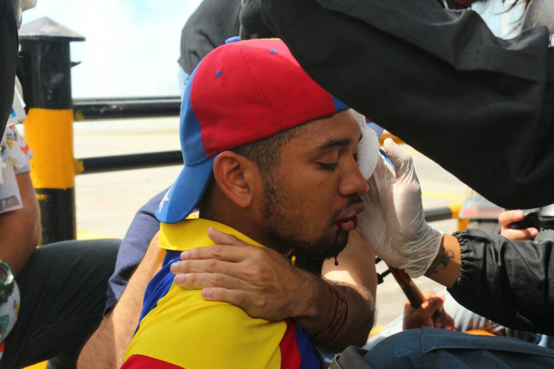 Violinista Wuilly Arteaga fue herido durante represión en Bello Campo #22Jul (VIDEO)