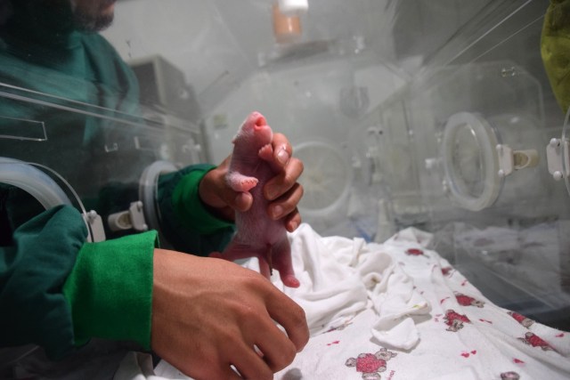 This photo taken on July 31, 2017 shows a panda cub born to a mixed pair of wild and captive parents in Wolong in China's southwestern Sichuan province. China has welcomed the world's first giant panda cub to be born to a mixed pair of captive and wild parents, the official Xinhua news agency said. Palm-sized and pink, covered in a downy layer of white fuzz from its tiny claws to its strangely long tail, the baby was born early morning on July 31 to 15-year-old mom Cao Cao at the Hetaoping semi-wild training base in the southwestern province of Sichuan. / AFP PHOTO / STR / China OUT