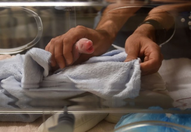A veterinarian holds the second of twin cubs born to panda Huan Huan in Saint-Aignan-sur-Cher, central France, on August 4, 2017. French zoo officials were doubly delighted on August 1 on learning that their pregnant panda is expecting not one but two cubs at the weekend. A final scan has revealed that Huan Huan, who is on loan to Beauval zoo in central France from China with her male partner Yuan Zi, is expecting twins on August 4 or 5. / AFP PHOTO / GUILLAUME SOUVANT