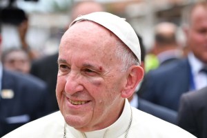 El Papa bromea sobre el golpe que se dio en la cara
