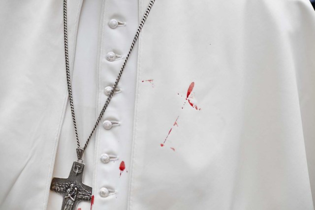 A few droplets of blood stain Pope Francis' white tunic from a bruise around his left eye and eyebrow caused by an accidental hit against the popemobile's window glass while visiting the old sector of Cartagena, Colombia, on September 10, 2017.REUTERS/Alberto PIZZOLI/Pool