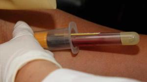 Al menos 15 muertos por un brote de hepatitis E en Namibia