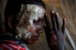Quemados o violadas, la pesadilla de los rohinyás (Fotos)