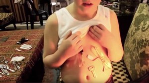 El “niño magnético”: Atrae objetos de metal como si tuviera un imán en su barriga (VIDEO)