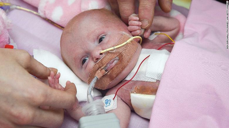 Una bebé que nació con el corazón fuera del cuerpo sobrevive a tres cirugías
